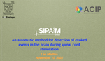 An automatic method for detection of evoked events in the brain during spinal cord stimulation